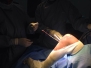 MPFL RECONSTRUCTION FOR PATELLA DISLOCATION